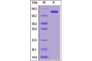 Fed Human FAP Protein, His Tag on  under reducing (R) condition.