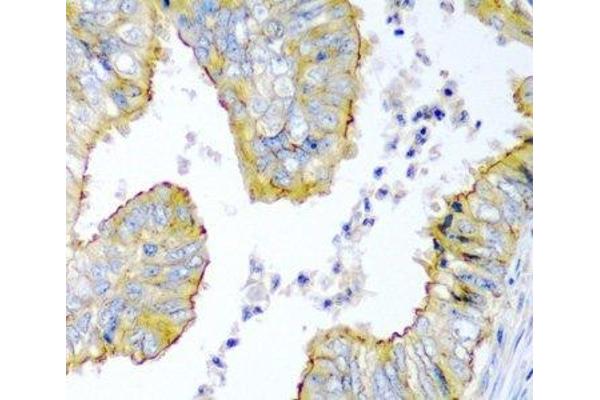 KRAB Box Domain Containing 4 (KRBOX4) antibody