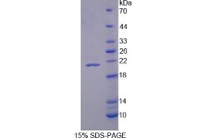 Image no. 1 for Vasoactive Intestinal Peptide (Vip) (AA 27-157) protein (His tag) (ABIN6236640) (Vip Protein (AA 27-157) (His tag))