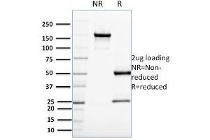 SDS-PAGE Analysis Purified CDC34 Mouse Monoclonal Antibody (CPTC-CDC34-2). (CDC34 antibody)