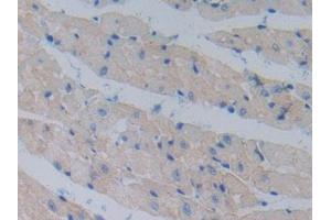 DAB staining on IHC-P; Samples: Mouse Heart Tissue (Cadherin 13 antibody  (AA 478-690))