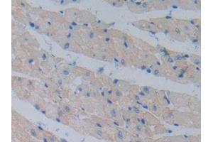 DAB staining on IHC-P; Samples: Mouse Heart Tissue