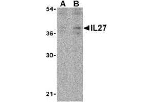 Western blot analysis of IL-27 in EL4 lysate with AP30420PU-N IL-27 antibody at (A) 2 and (B) 4 μg/ml. (IL27 antibody  (N-Term))