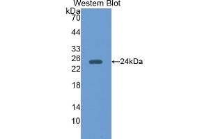 Western blot analysis of the recombinant protein. (Peroxiredoxin 5 antibody  (AA 1-213))