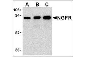Western blot analysis of (A) 25 ng, (B) 50 ng, and (C) 100 ng of purified recombinant NGFR with this product at 1 μg/ml. (NGFR antibody)