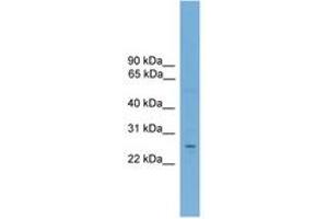 Image no. 1 for anti-Nuclear Receptor Subfamily 6, Group A, Member 1 (NR6A1) (AA 323-372) antibody (ABIN6744807) (NR6A1 antibody  (AA 323-372))
