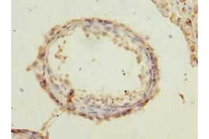 Immunohistochemistry of paraffin-embedded human testis tissue using ABIN7168477 at dilution of 1:100 (RUNDC3A antibody  (AA 1-405))