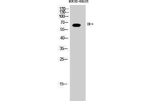 Western Blotting (WB) image for anti-Estrogen Receptor 1 (ESR1) (Ser363) antibody (ABIN3175024) (Estrogen Receptor alpha antibody  (Ser363))