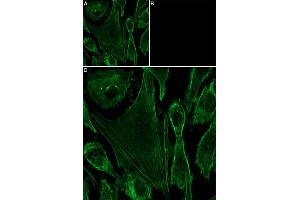 Unlabeled α-Conotoxin GI successfully blocks α-Conotoxin GI-ATTO Fluor-647N binding. (alpha-conotoxin GI peptide (Atto 647N))