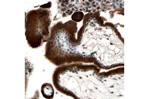 Immunohistochemical staining of human placenta with C3orf63 polyclonal antibody  shows strong cytoplasmic positivity in trophoblastic cells at 1:500-1:1000 dilution.