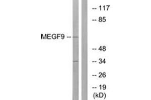 Western blot analysis of extracts from COLO cells, using MEGF9 Antibody. (MEGF9 antibody  (AA 383-432))