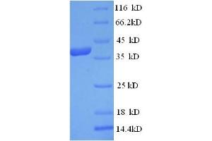 SDS-PAGE (SDS) image for Carboxypeptidase A3 (Mast Cell) (CPA3) (AA 110-417) protein (His tag) (ABIN5713376) (CPA3 Protein (AA 110-417) (His tag))