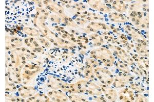 ABIN6262571 and ABIN6277224 at 1/100 staining Rat kidney tissue by IHC-P. (Interleukin enhancer-binding factor 3 (ILF3) (Internal Region) antibody)