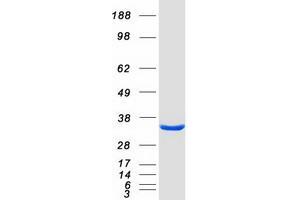 ECHDC3 Protein (Myc-DYKDDDDK Tag)