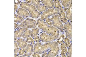 Immunohistochemistry of paraffin-embedded mouse kidney using FKBP6 antibody at dilution of 1:100 (x400 lens). (FKBP6 antibody)