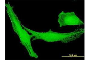 Immunofluorescence of purified MaxPab antibody to LRRC23 on HeLa cell. (LRRC23 antibody  (AA 1-343))