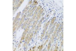 Immunohistochemistry of paraffin-embedded mouse stomach using RARS2 antibody (ABIN5974692) at dilution of 1/100 (40x lens). (RARS2 antibody)