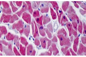 Human Heart: Formalin-Fixed, Paraffin-Embedded (FFPE)