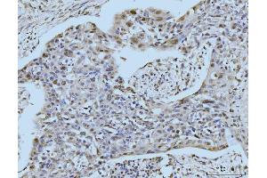 IHC analysis of SBNO1 using anti-SBNO1 antibody (ABIN7601710).