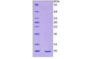 SDS-PAGE of Protein Standard from the Kit (Highly purified E. (Insulin ELISA Kit)