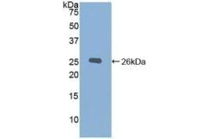 Detection of Recombinant CHRD, Mouse using Polyclonal Antibody to Chordin (CHRD)
