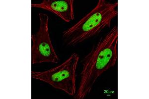 Immunofluorescent analysis of Hela cells, using KRBA2 Antibody (Center) (ABIN655380 and ABIN2844933). (KRBA2 antibody  (AA 157-186))