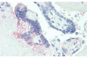 Detection of PLGF in Human Placenta Tissue using Polyclonal Antibody to Placenta Growth Factor (PLGF) (PLGF antibody  (AA 24-158))