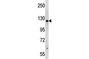 PARP antibody western blot analysis in HeLa lysate (PARP1 antibody  (AA 183-214))