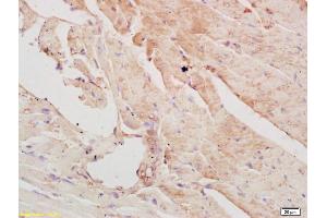 Formalin-fixed and paraffin embedded mouse heart labeled with Rabbit Anti PAPK/ALS2CR2 Polyclonal Antibody, Unconjugated (ABIN751273) at 1:200 followed by conjugation to the secondary antibody and DAB staining (STRADB antibody  (AA 251-350))