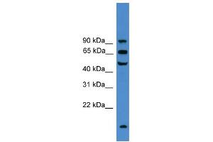 WB Suggested Anti-UMOD Antibody Titration:  0. (Uromodulin antibody  (C-Term))