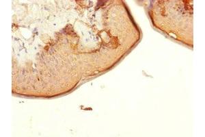 Immunohistochemistry of paraffin-embedded human skin tissue using ABIN7147366 at dilution of 1:100 (CENPK antibody  (AA 1-269))