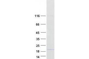 DDA1 Protein (Myc-DYKDDDDK Tag)