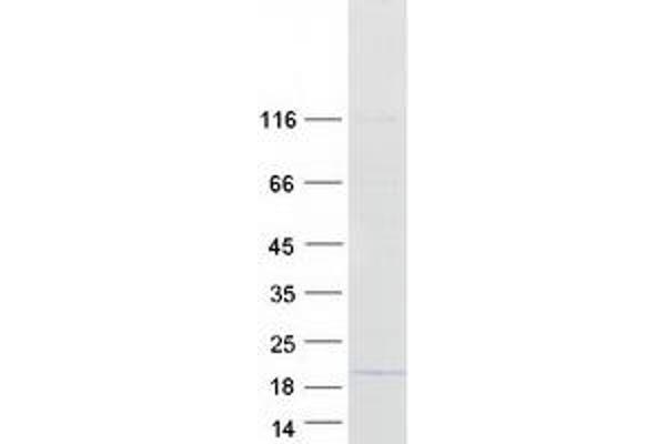 DDA1 Protein (Myc-DYKDDDDK Tag)