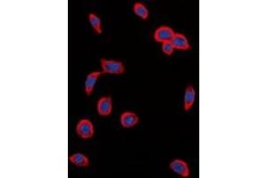 Immunofluorescent analysis of VEGFR2 (pY1214) staining in MCF cells.