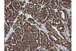 Image no. 2 for anti-RAB30, Member RAS Oncogene Family (RAB30) antibody (ABIN1500558) (RAB30 antibody)