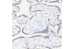 Immunohistochemistry of paraffin-embedded human placenta using CLUH antibody  at dilution of 1:100 (40x lens). (CLUH antibody  (AA 1120-1309))