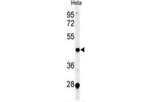 Western blot analysis of CHN2 (arrow) in Hela cell line lysates (35ug/lane) using ARHGAP3/CHN2  (CHN2 antibody  (Middle Region))