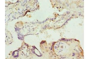 Immunohistochemistry of paraffin-embedded human placenta tissue using ABIN7156320 at dilution of 1:100 (ITPK1 antibody  (AA 185-414))