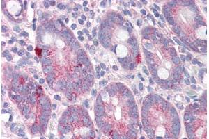 Human Small Intestine (formalin-fixed, paraffin-embedded) stained with SLC9A1 antibody ABIN343902 at 5 ug/ml followed by biotinylated goat anti-rabbit IgG secondary antibody ABIN481713, alkaline phosphatase-streptavidin and chromogen. (SLC9A1 antibody  (C-Term))