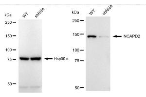 Western blotting analysis using NCAPD2 antibody (ABIN7800957).