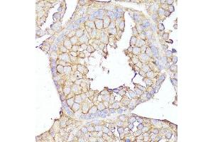 Immunohistochemistry of paraffin-embedded mouse testis using MME antibody. (MME antibody  (AA 52-352))