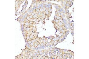 Immunohistochemistry of paraffin-embedded mouse testis using MME antibody.