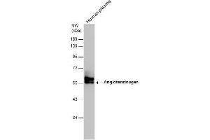 WB Image Human tissue extract (30 μg) was separated by 10% SDS-PAGE, and the membrane was blotted with Angiotensinogen antibody [N1C3] , diluted at 1:500. (AGT antibody)
