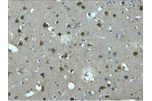 IHC staining of Human brain tissue paraffin-embedded, diluted at 1:200. (MAP2 antibody)