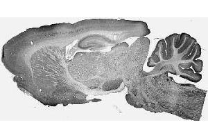 Adult rat brain immunohistochemistry.