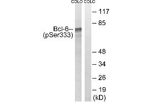 Western blot analysis of extracts from COLO cells, treated with insulin (0. (BCL6 antibody  (pSer333))