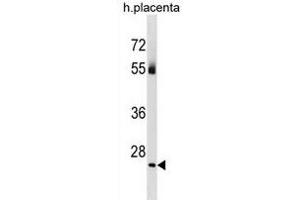 TBC1D26 Antibody (C-term) (ABIN1881871 and ABIN2838991) western blot analysis in human placenta tissue lysates (35 μg/lane).