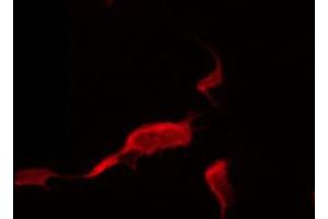 ABIN6274388 staining HeLa by IF/ICC. (ADCK5 antibody  (N-Term))