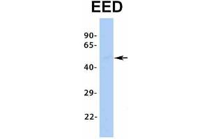 Host:  Rabbit  Target Name:  EED  Sample Type:  Human Fetal Liver  Antibody Dilution:  1.