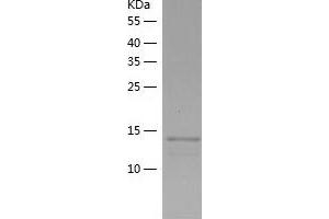 Western Blotting (WB) image for Immunoglobulin J Polypeptide, Linker Protein For Immunoglobulin alpha and mu Polypeptides (IGJ) (AA 23-159) protein (His tag) (ABIN7123407) (IGJ Protein (AA 23-159) (His tag))